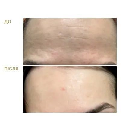 Braderm Kurage Cream Нічний крем з кислотами та ретинолом, 30мл 1810 фото