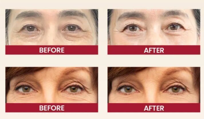 K-Secret SEOUL 1988 Eye Cream: Retinal Liposome 4% + Fermented Bean Антивіковий крем для шкіри навколо очей з ретиналем, 30мл 2216 фото
