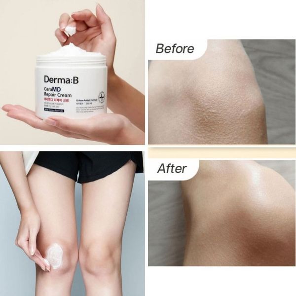 Derma:B CeraMD Repair Cream Крем для тіла з керамідами, 430мл 1872 фото