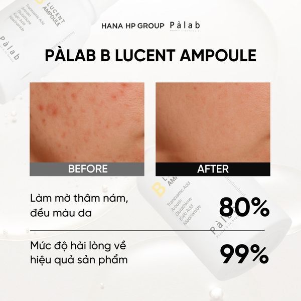 PALAB B LUCENT AMPOULE Сироватка для обличчя з транексамовою та койєвою кислотами, 30мл 2942 фото