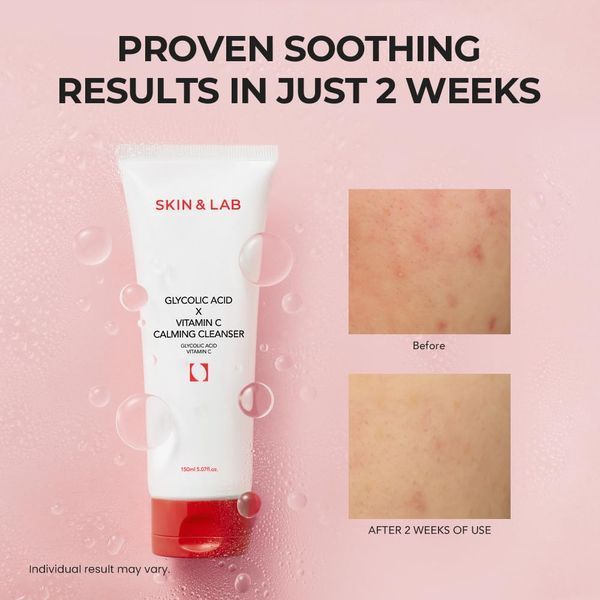 SKIN&LAB Glycolic Acid &times; Vitamin C Calming Cleanser Заспокійливий гель для очищення з гліколевою кислотою та вітаміном C, 150мл 2667 фото