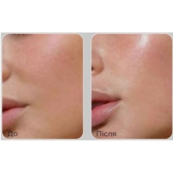 Medi-Peel Peptide 9 Volume Lifting All-In-One Essence PRO Ліфтинг-есенція для обличчя з пептидами, 100мл 1426 фото