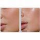 Medi-Peel Peptide 9 Volume Lifting All-In-One Essence PRO Ліфтинг-есенція для обличчя з пептидами, 100мл 1426 фото 5