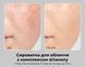 Medi-Peel Peptide 9 Vitanol Ampoule Pro Сироватка для обличчя з пептидами та вітамінним комплексом, 30мл 1456 фото 5