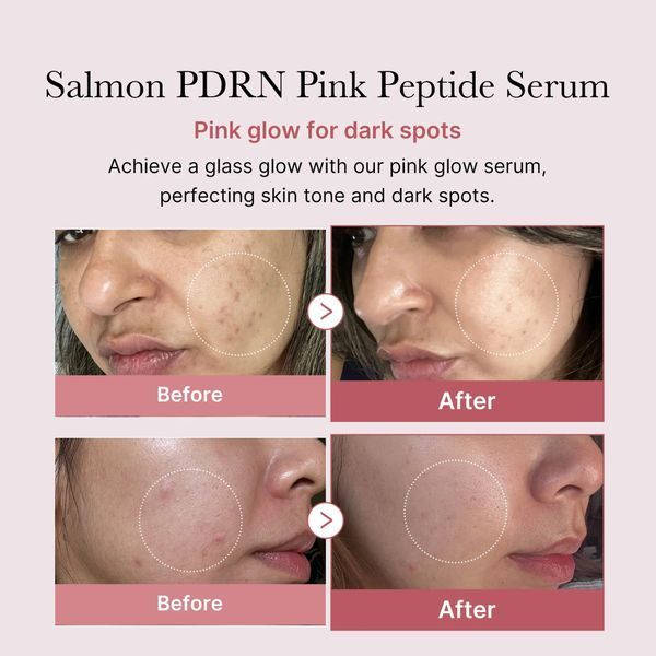 Medicube PDRN Pink Peptide Serum Відновлювальна сироватка з полінуклеотидами та пептидами, 30мл 2142 фото