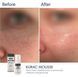 Braderm Kurac Cleansing Mousse Пінка для вмивання, 100мл 1804 фото 5