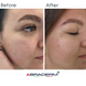 Braderm Kurac Cleansing Mousse Пінка для вмивання, 100мл 1804 фото 6
