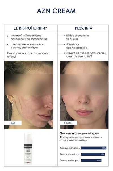 Braderm AZN Cream Денний зволожувальний крем з пребіотиками SPF 30, 30мл 1805 фото