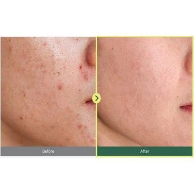 Anua Heartleaf 77% Soothing Заспокійливий тонер для обличчя з екстрактом хауттюйнії, 40мл 1372 фото