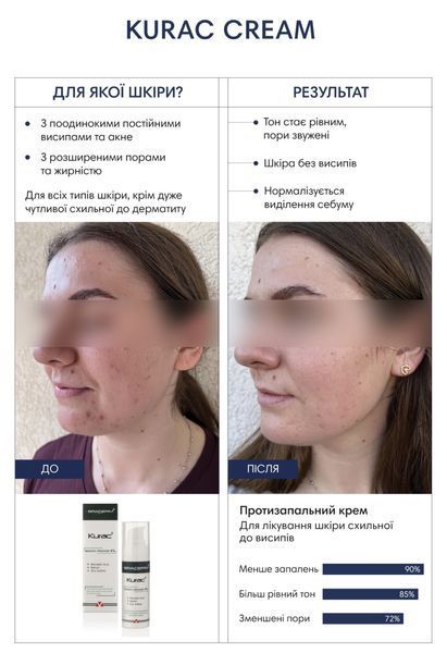 Braderm Kurac Cream Протизапальний крем для шкіри з акне, 30мл 1806 фото