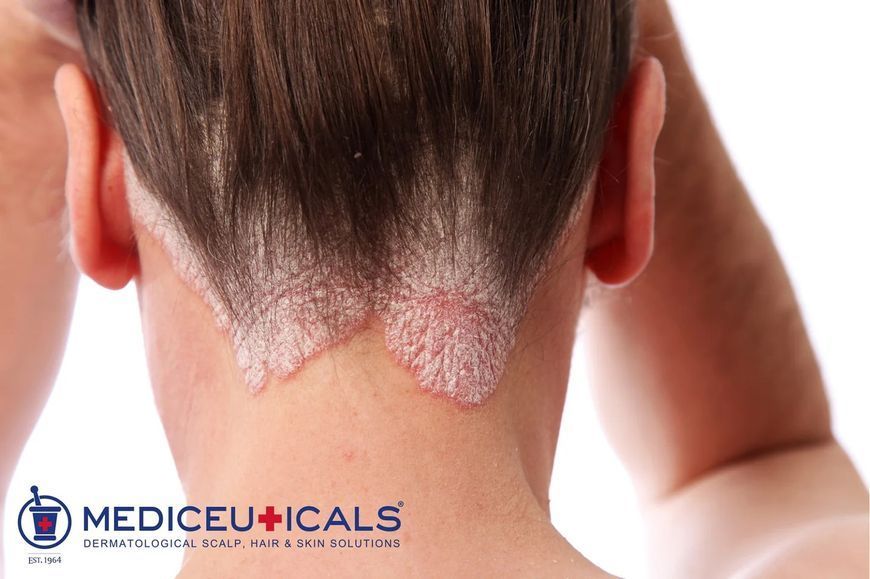 Mediceuticals X-Folate&trade; Шампунь проти лупи, себорейного дерматиту та різних проблем шкіри голови, 250мл 1755 фото